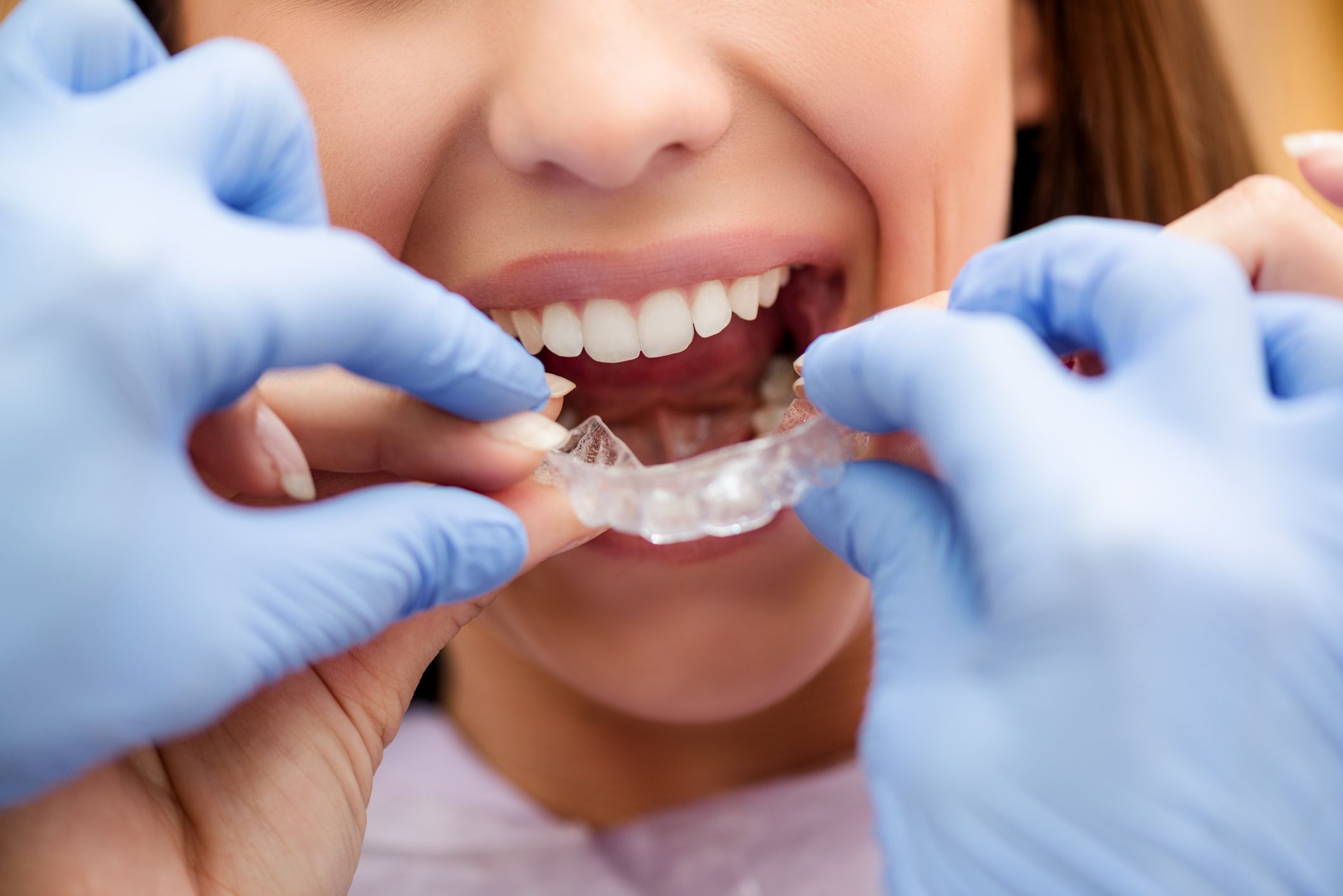 Curso de Endodontia